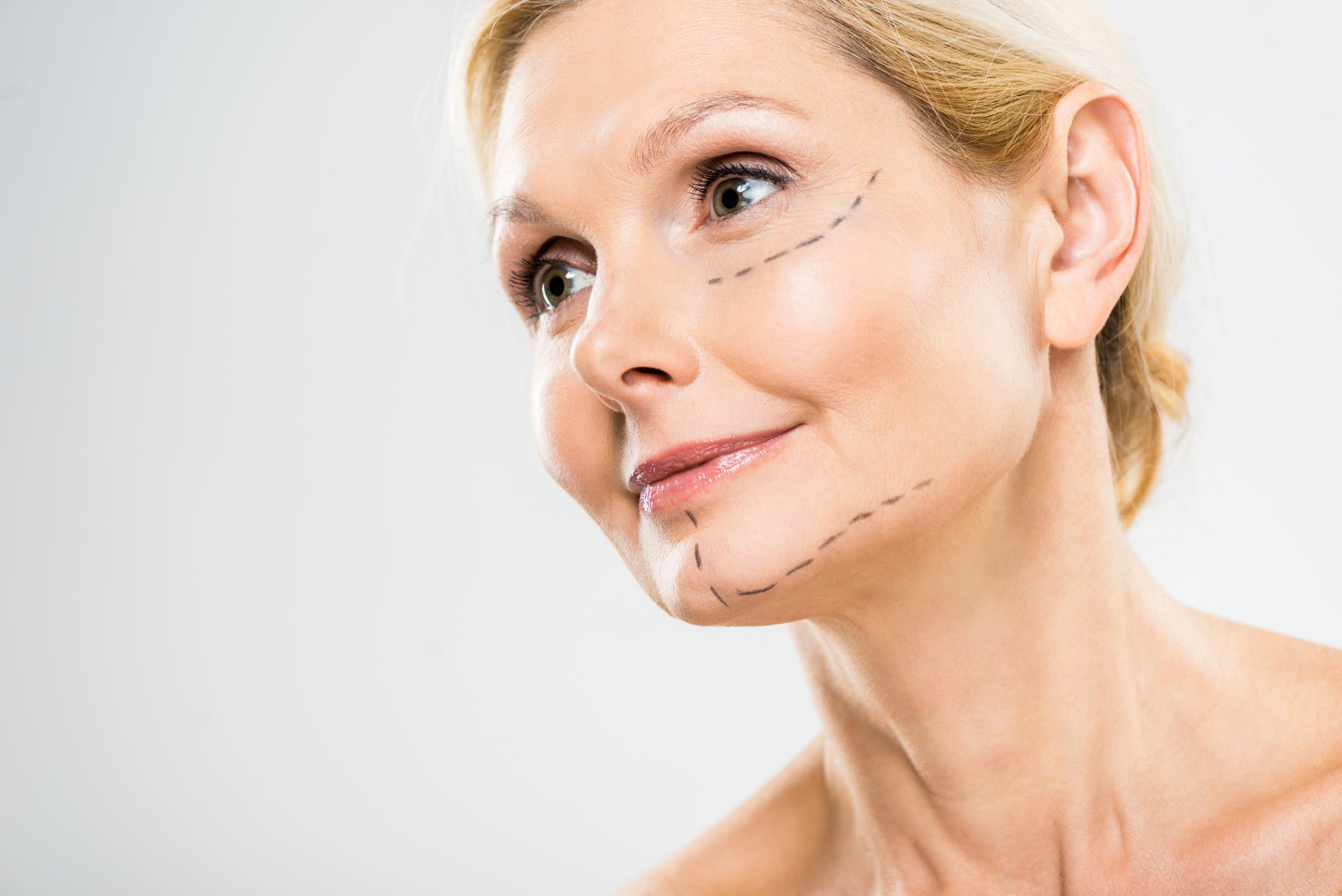 Beautiful,And,Middle,Aged,Woman,With,Lines,On,Face,Looking